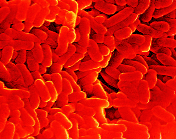 Image: False-color scanning electron micrograph, SEM, of the rod-like bacteria Mycobacterium tuberculosis, causative agent of tuberculosis in humans (Photo courtesy of CNRI).